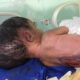 Newborn baby with birth defects in Al-Fallujah